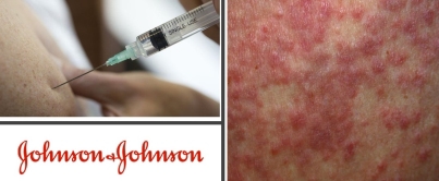 J&J logo, syringe and rashes