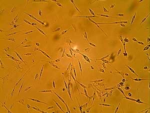 Reduced mesothelioma cells