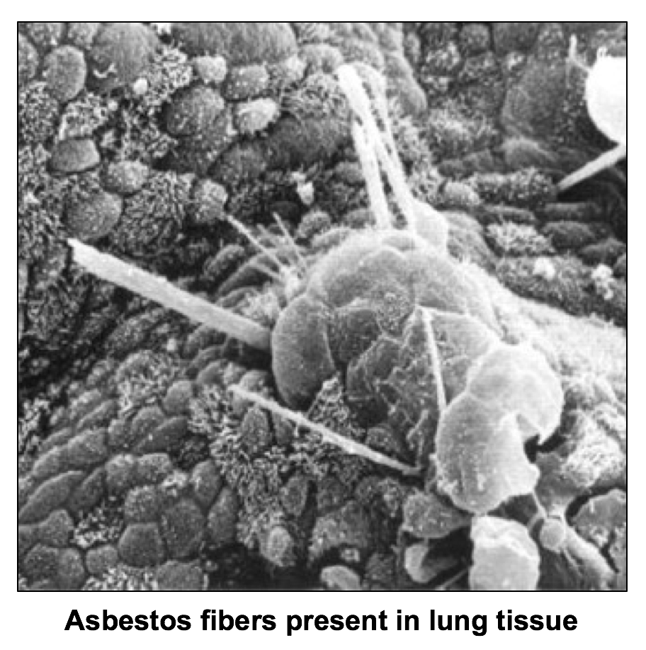 Asbestos