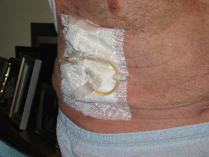 Joe's drain tube
