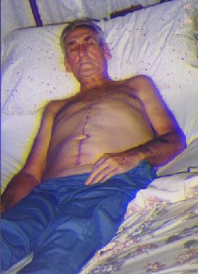 Henry Dagon, post surgery