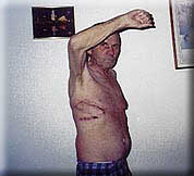 Charles Lenhart, Post EPP, November, 2000
