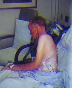 Bulan Wheech - Post Surgery